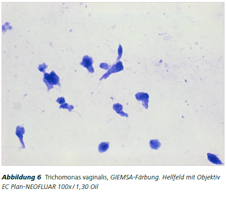 Abbildung 6 Trichomonas vaginalis, GIEMSA-Färbung. Hellfeld mit Objektiv
EC Plan-NEOFLUAR 100x / 1,30 Oil